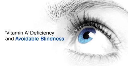 Why does a deficiency of vitamin A cause night blindness?