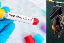 Nipah Virus