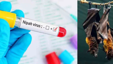 Nipah Virus