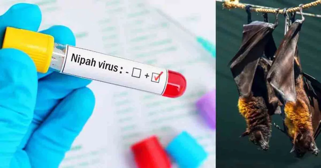 Nipah Virus