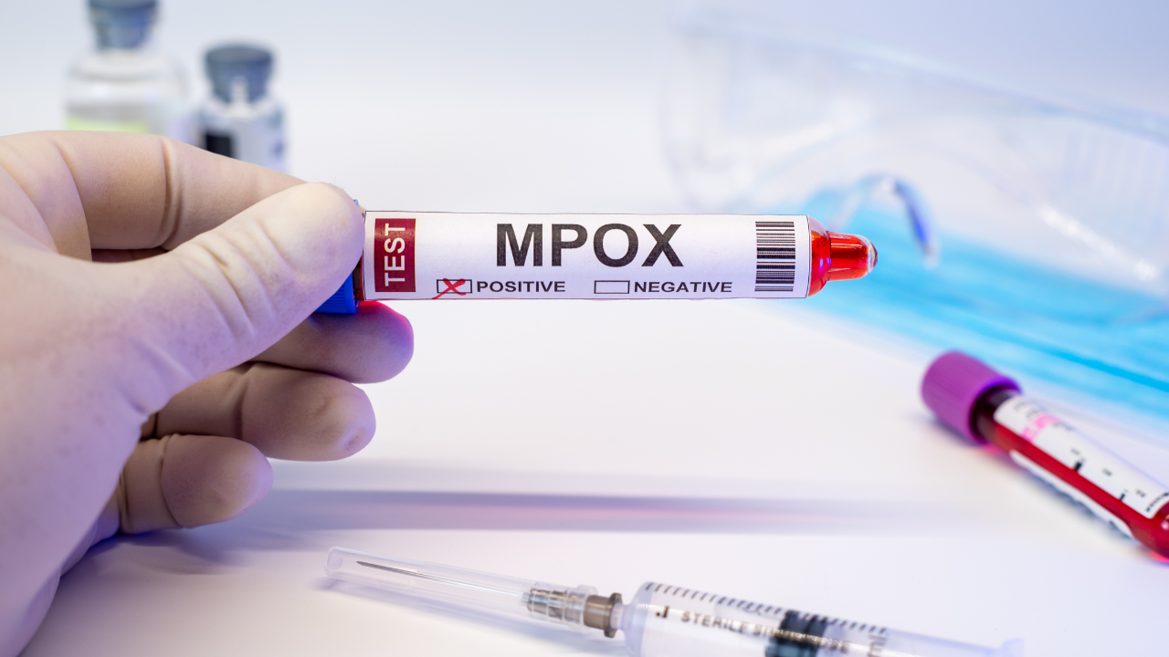 Why should the public be informed about symptoms, prevention, and vaccines of Mpox Virus? 